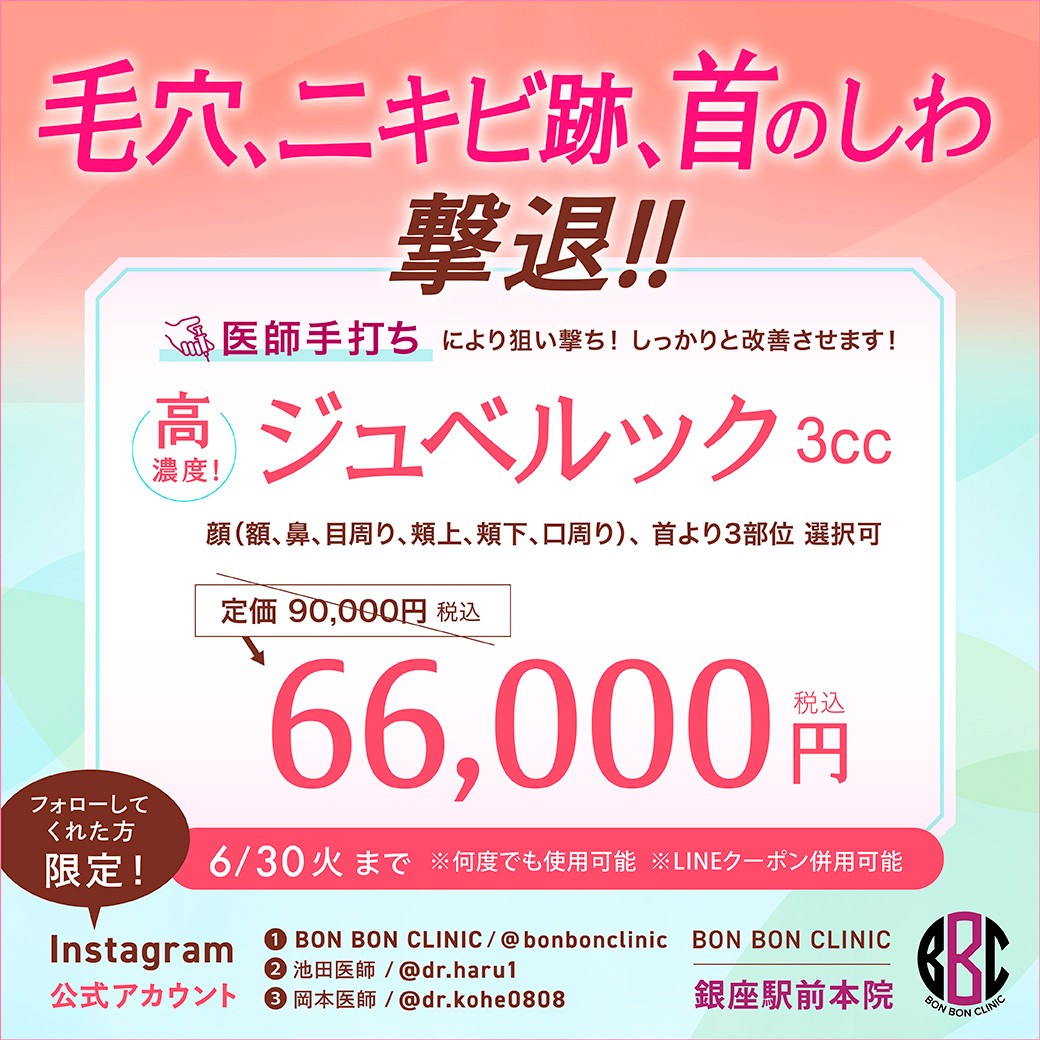 ジュベルックのクーポン画像