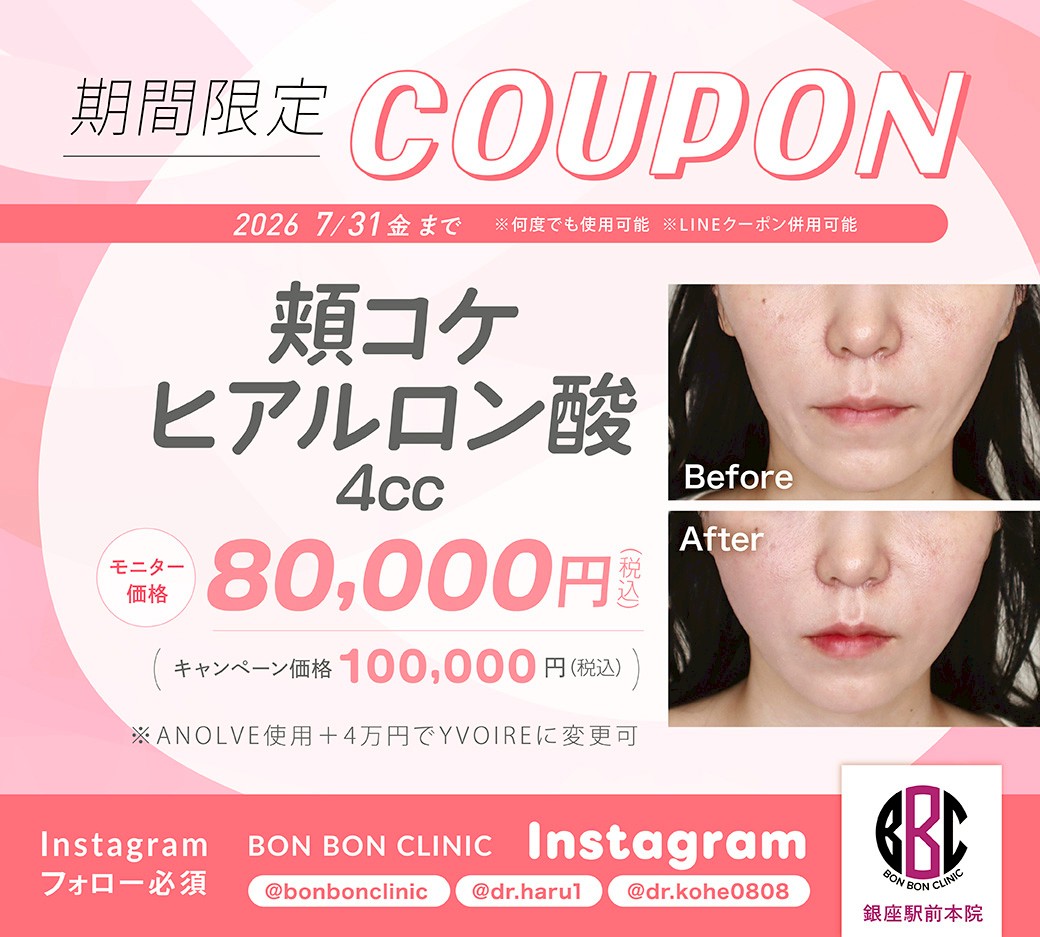 頬コケヒアルロン酸4ccのクーポン画像