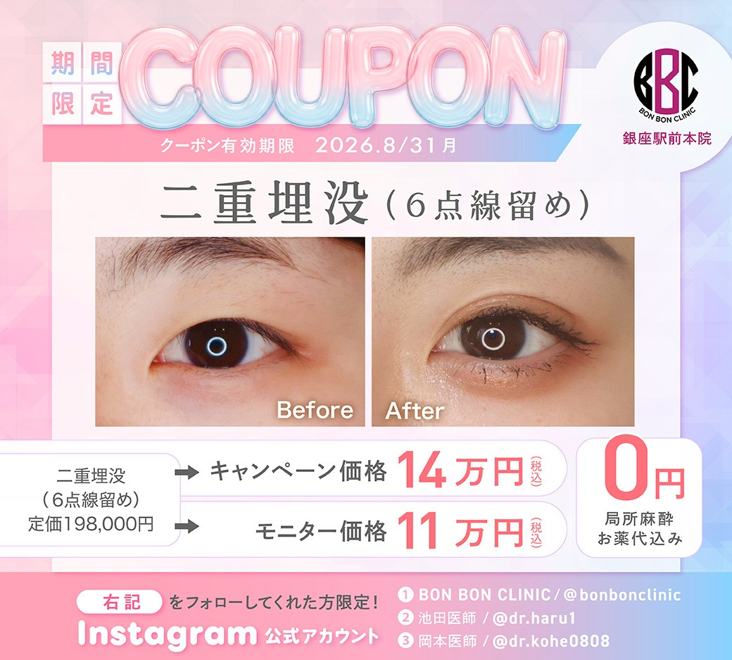 二重埋没のクーポン画像