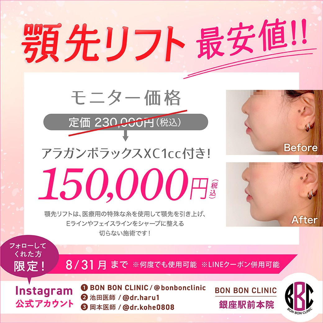 顎先リフトのクーポン画像
