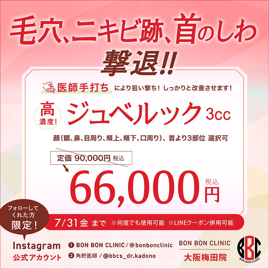 ジュベルックのクーポン画像
