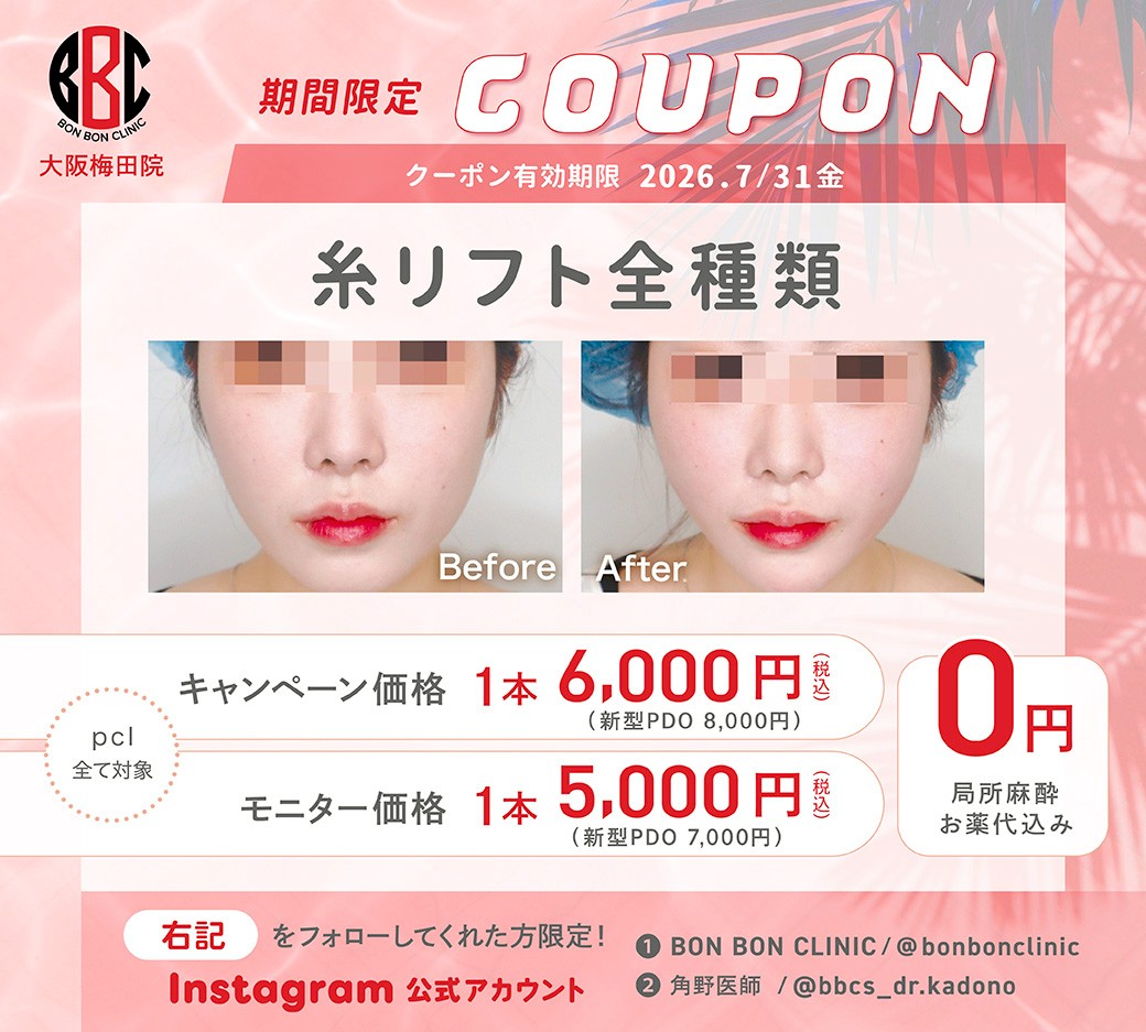 糸リフトのクーポン画像
