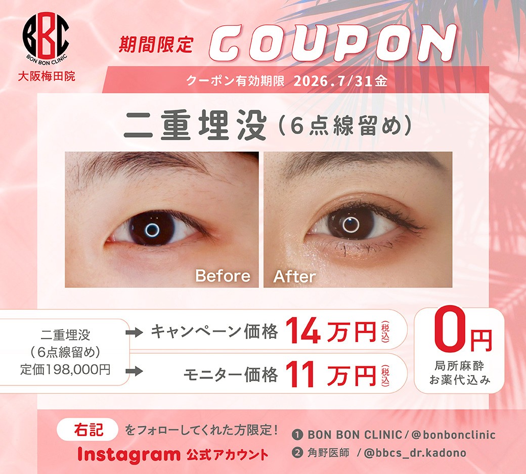 二重埋没のクーポン画像
