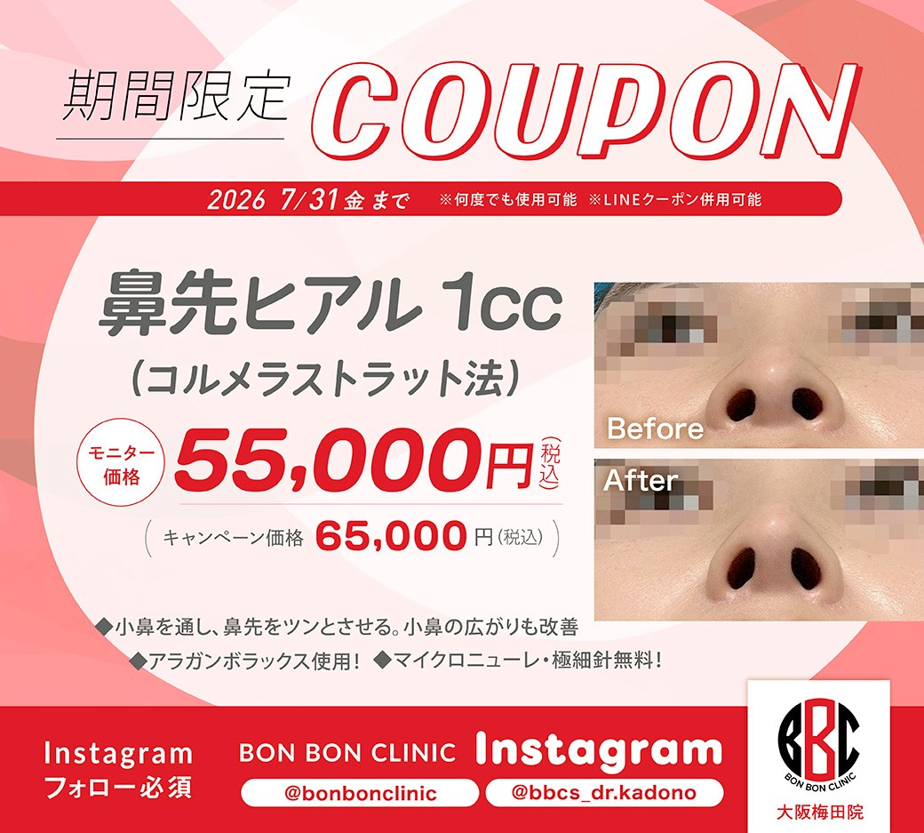 鼻先ヒアルロン酸1ccのクーポン画像