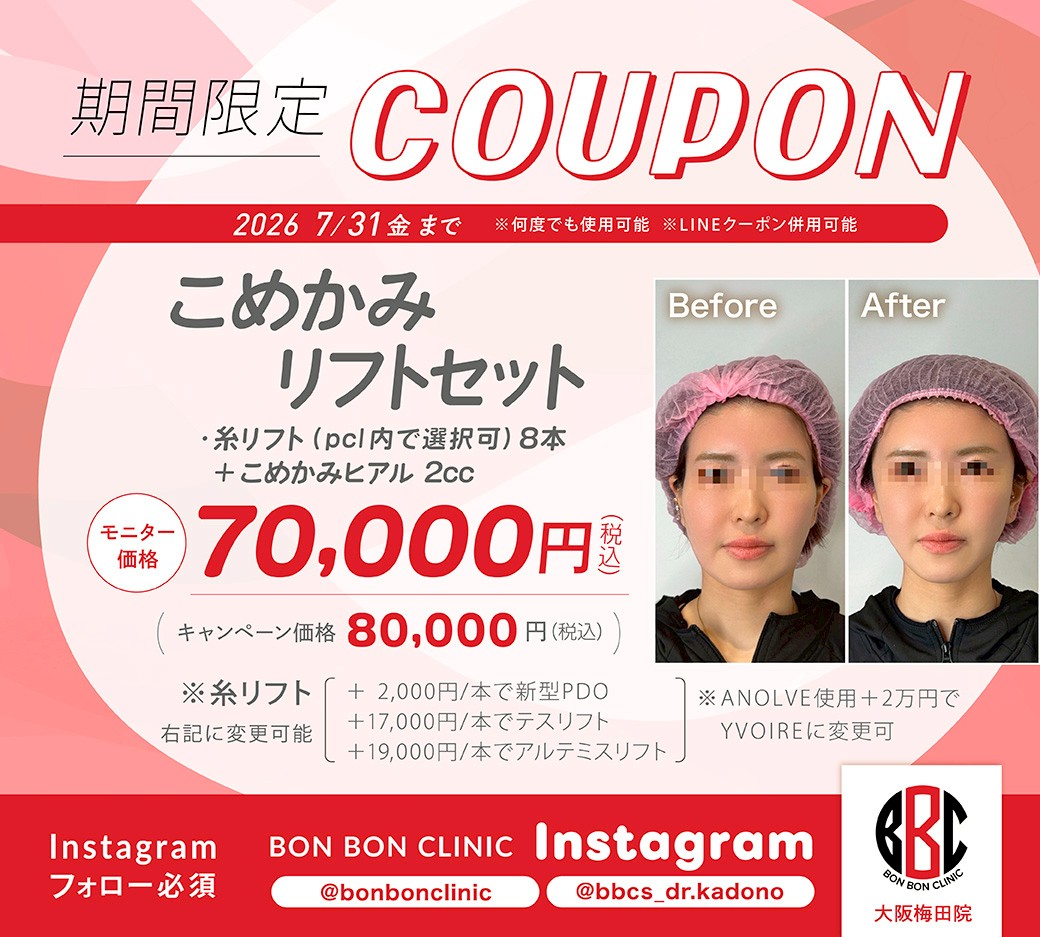 こめかみリフトのクーポン画像