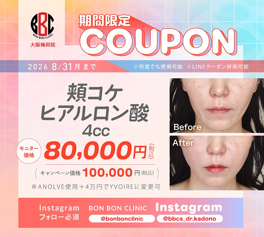 頬コケヒアルロン酸4ccのクーポン画像