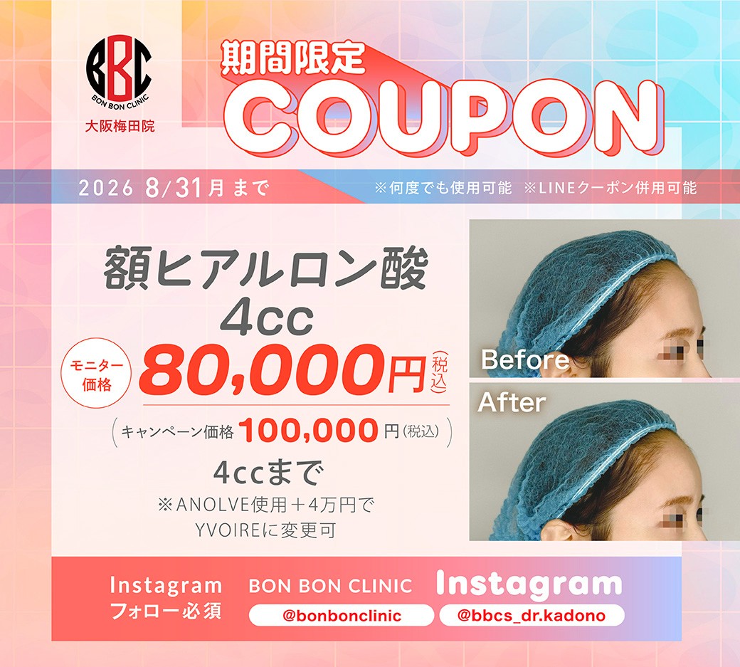 額ヒアルロン酸4ccのクーポン画像