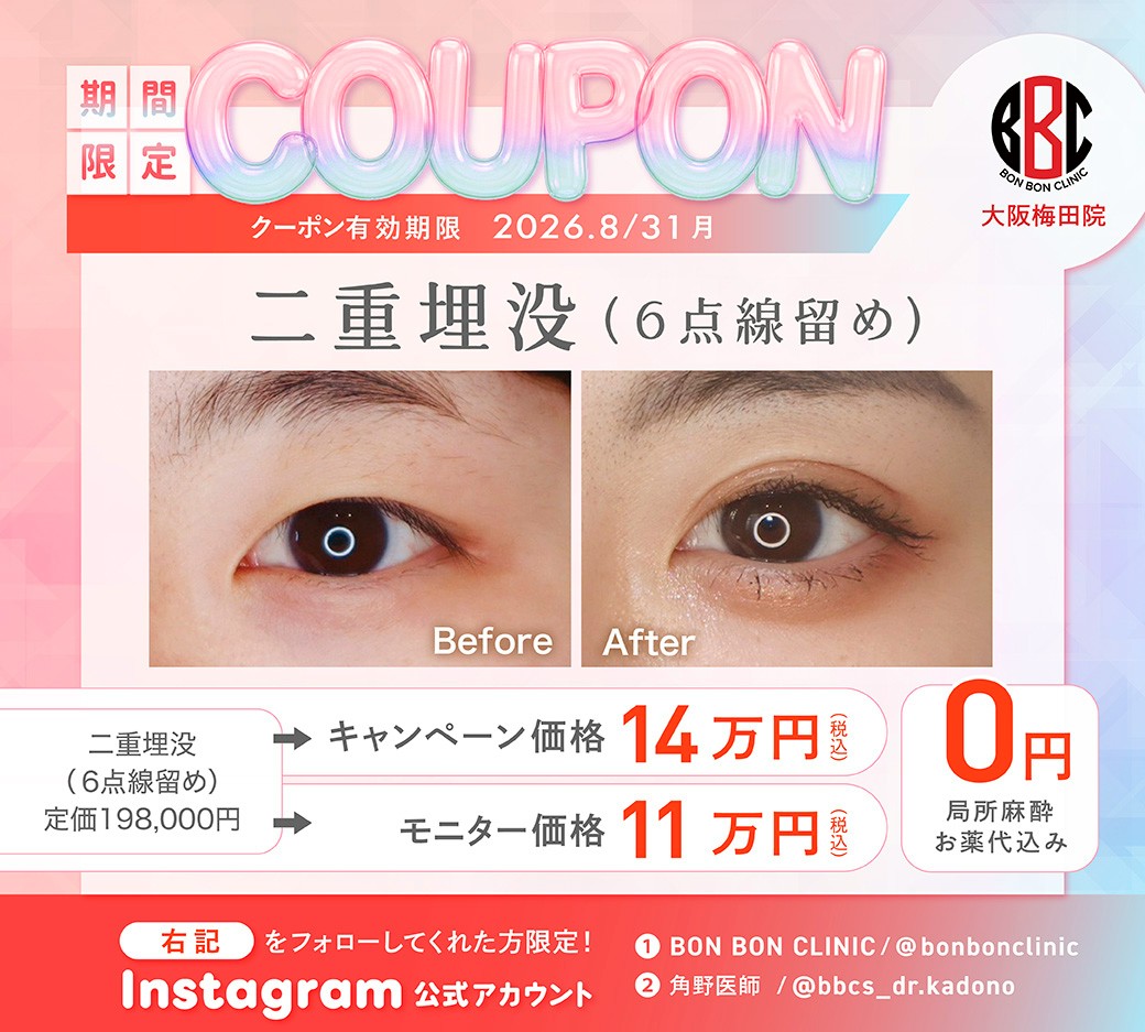 二重埋没のクーポン画像