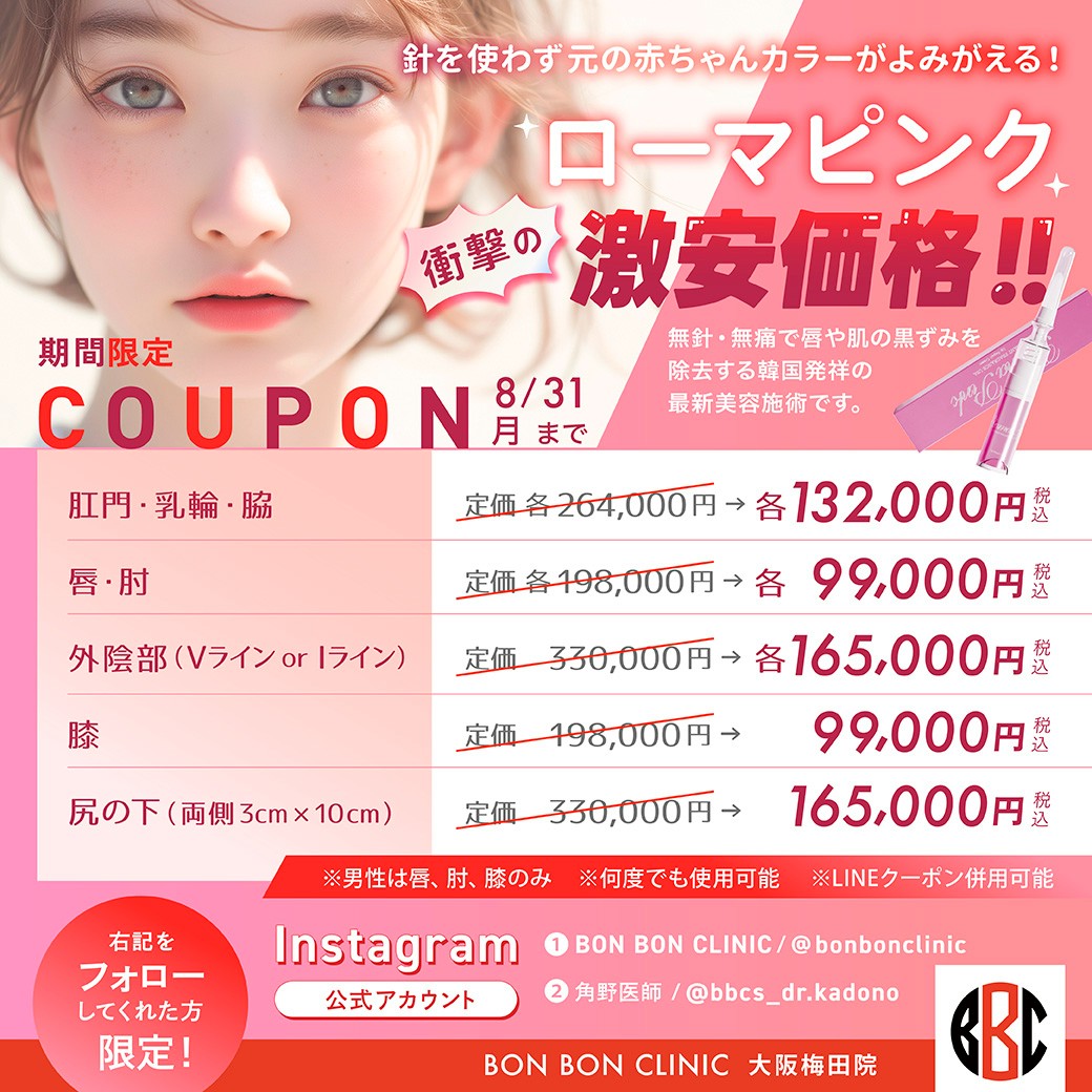 ローマピンクのクーポン画像