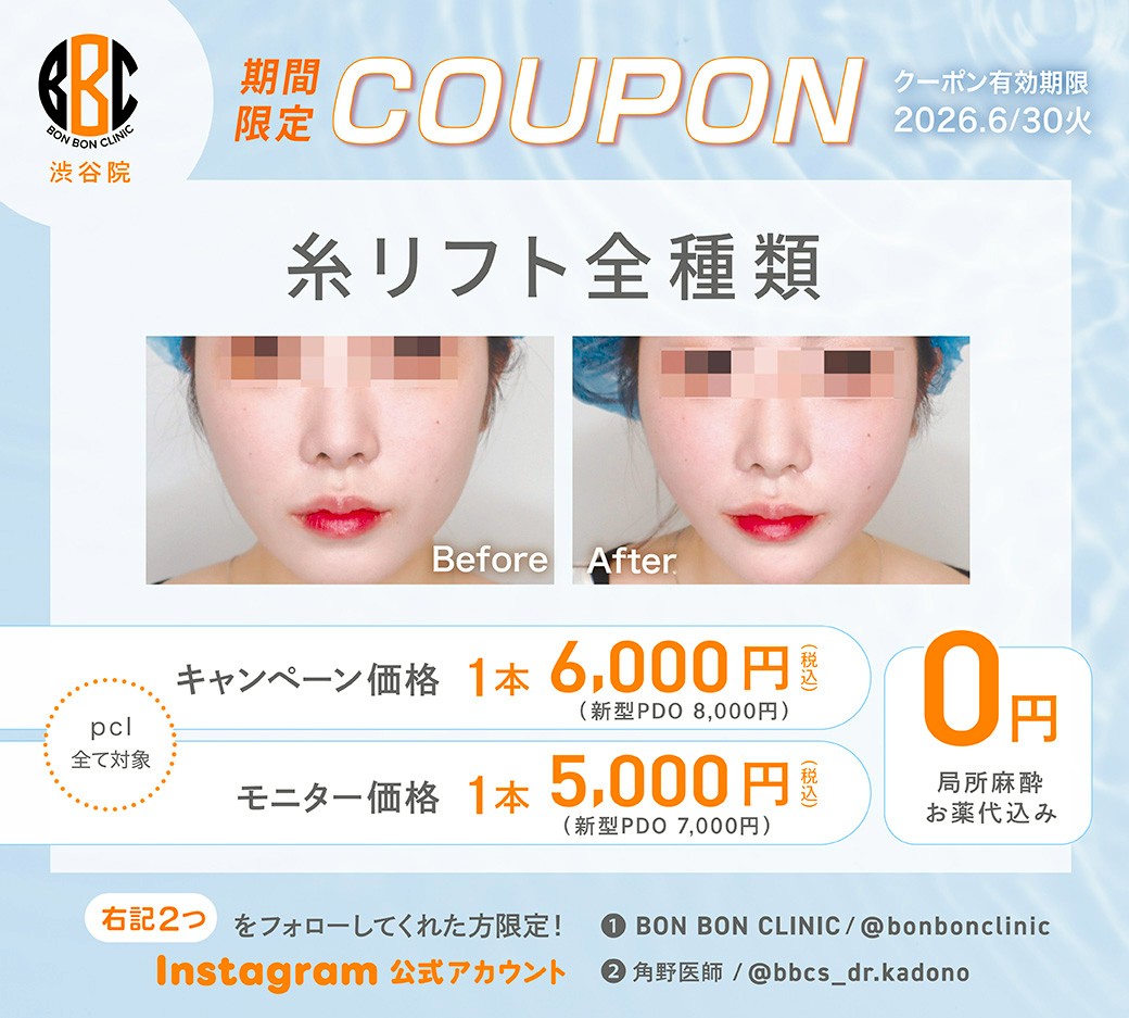 糸リフトのクーポン画像
