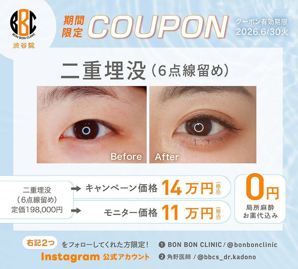 二重埋没法のクーポン画像