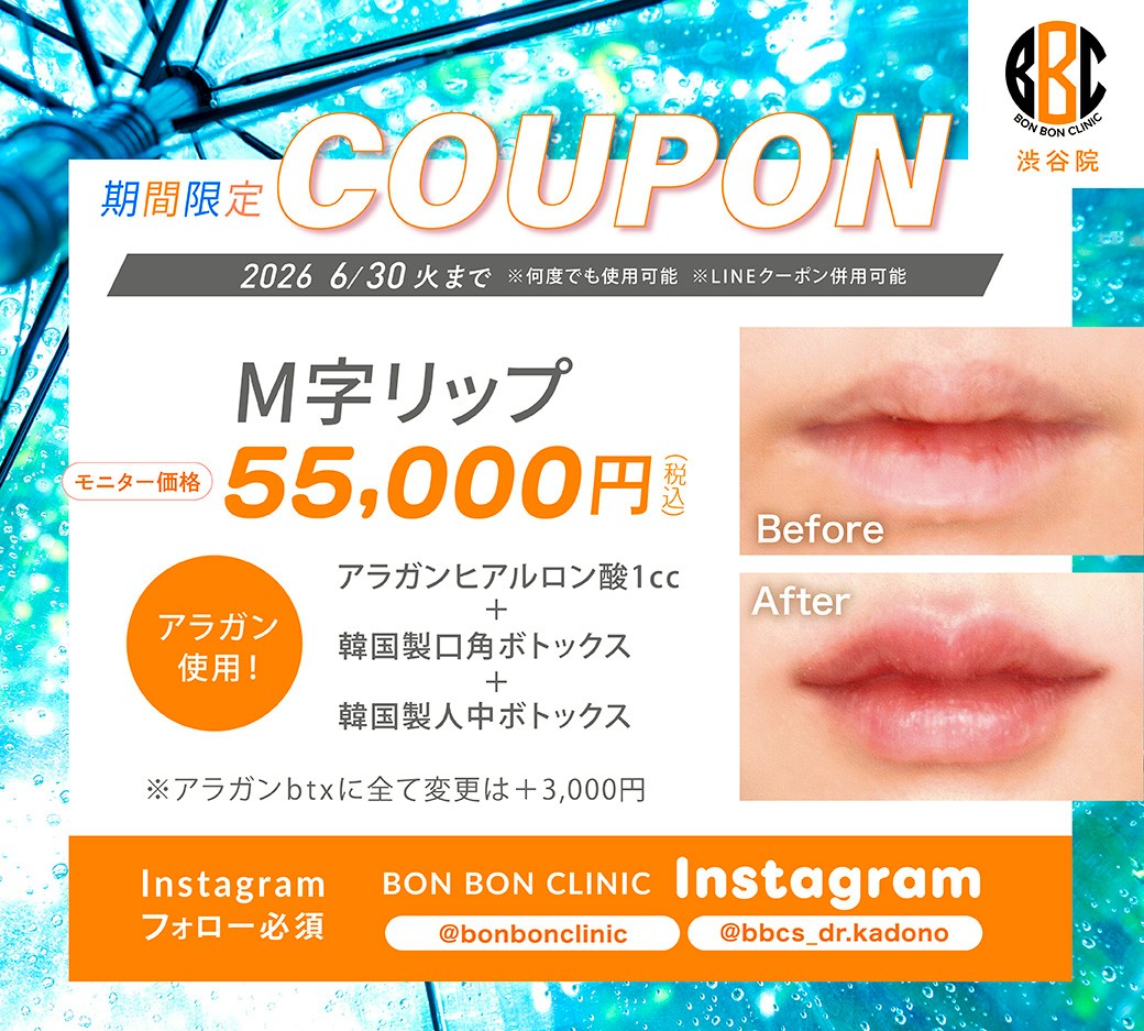 M字リップのクーポン画像