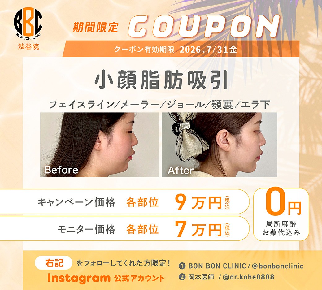 小顔脂肪吸引のクーポン画像