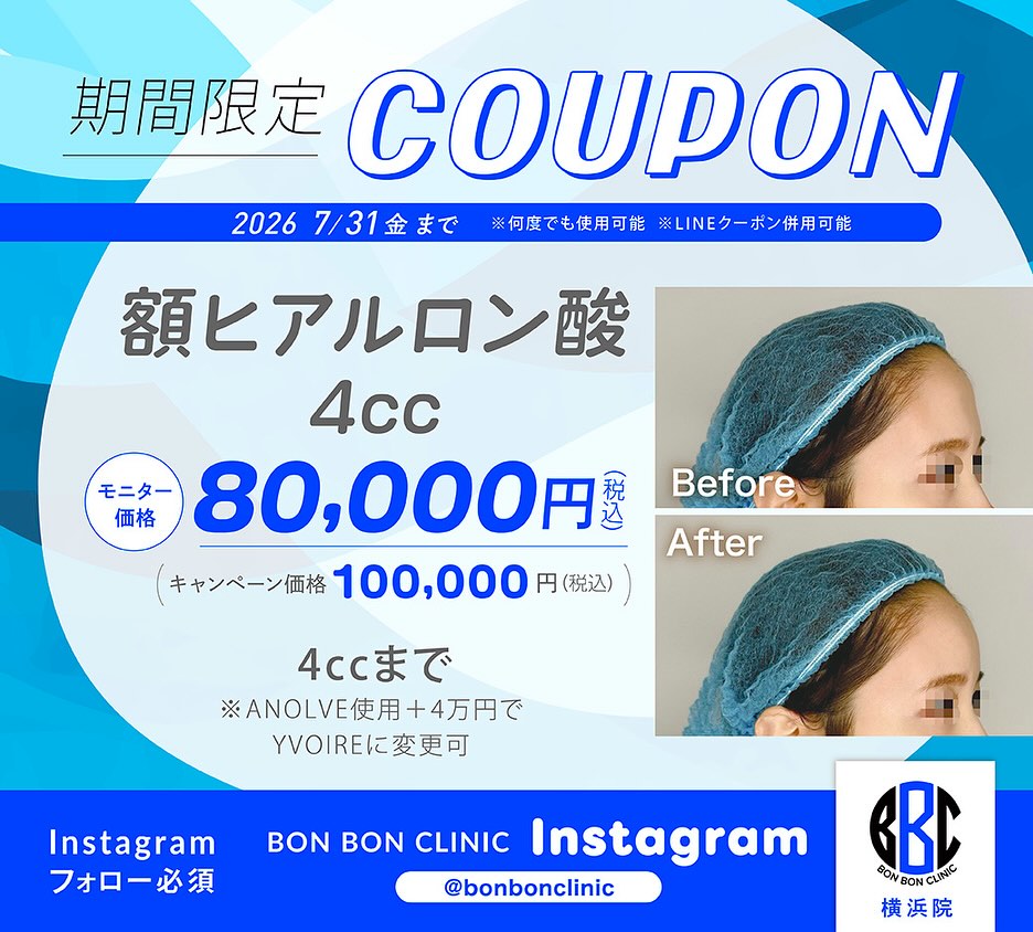 額ヒアルロン酸4ccのクーポン画像