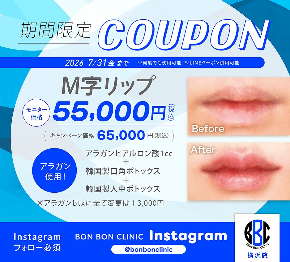 M字リップ画像