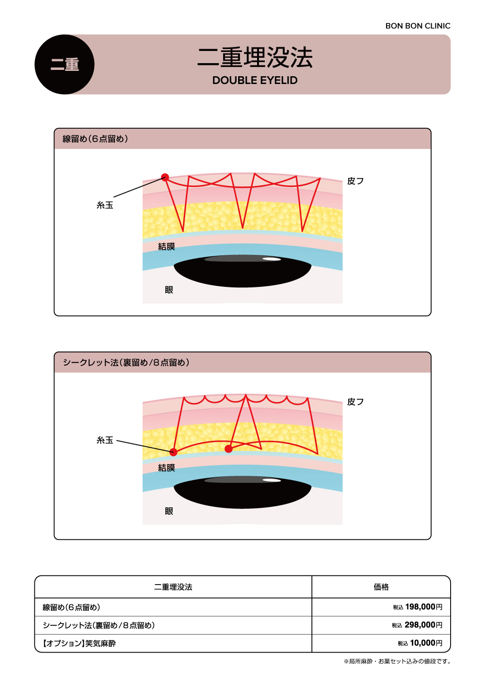 二重埋没法ならボンボンクリニック